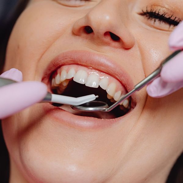 How Dental Implants Can Boost Your Confidence and Smile - 1.jpg