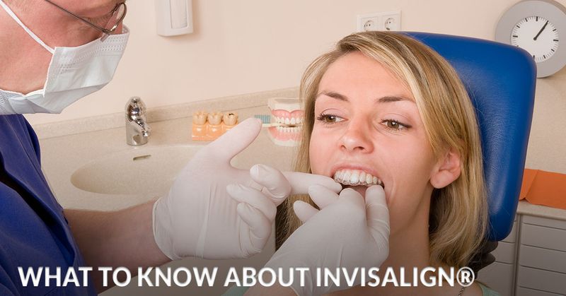 What-to-know-about-invisalign-5adf84f370db8.jpg