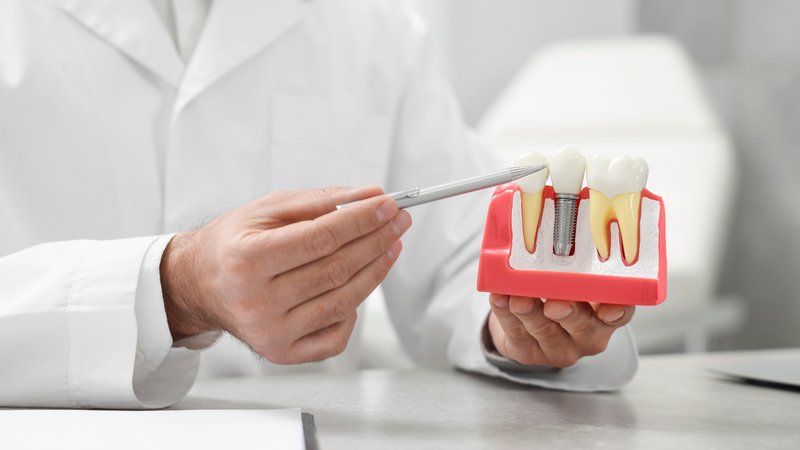 Dental Implants vs. Other Tooth Replacement Options.png