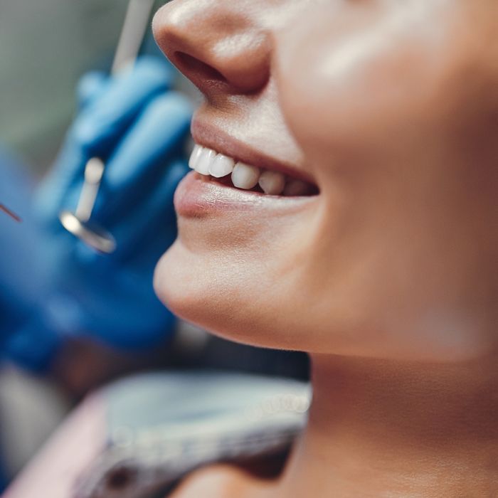 woman smiling at the dentist