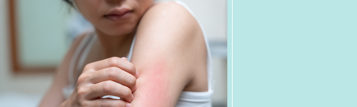 acne skin problems mental health psoriasis excema (1).png