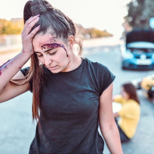 woman bleeding from crash