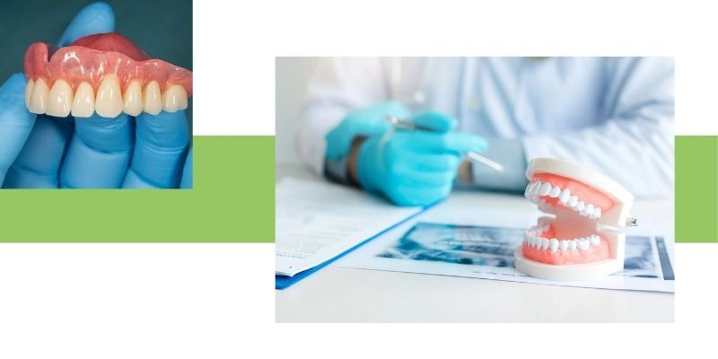 Full Dentures Img 2.jpg