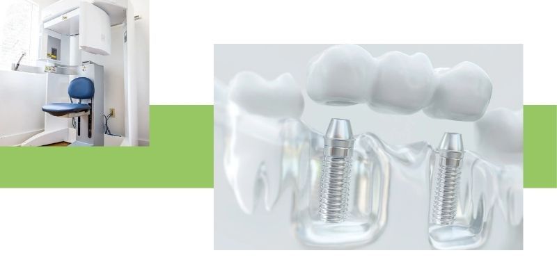 Dental Implant IMG 2.jpg