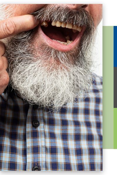 Implant Crowns Img 1.jpg