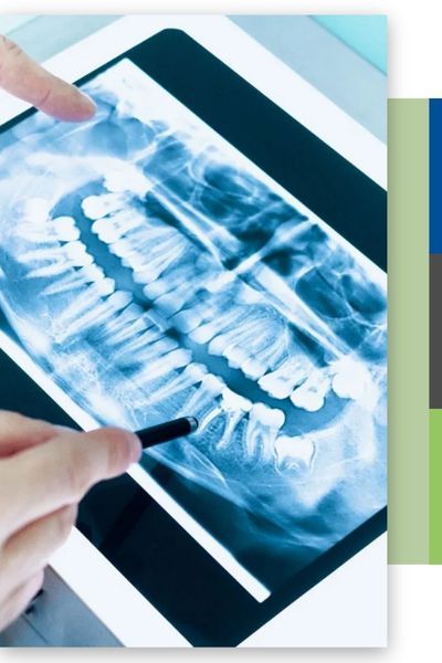 Extractions Img 1.jpg