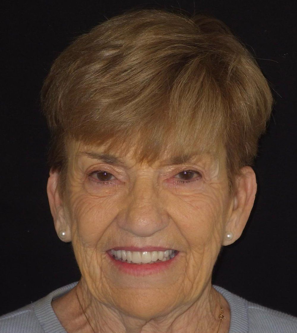 smiling woman with dentures