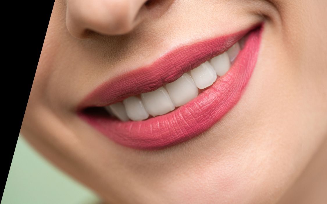 whitening Angled.jpg