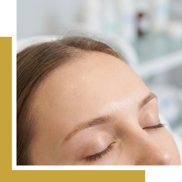 Close-up of a relaxed woman resting with her eyes closed, showcasing a smooth, wrinkle-free forehead achieved through the even diffusion of a Dysport treatment.