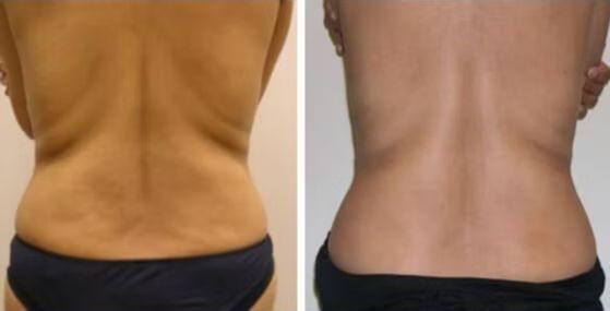 VShape Before and After.jpg