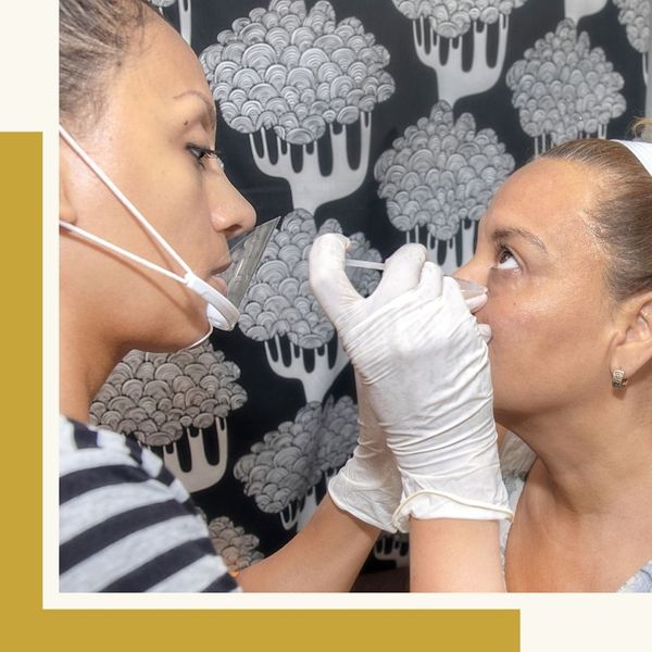 giving patient prp below eyelids