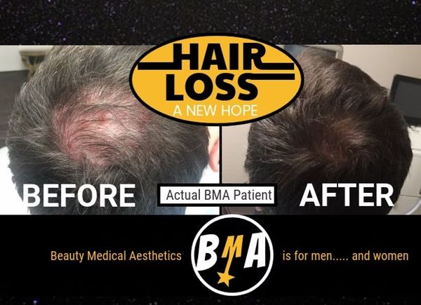 hair loss before after.jpg