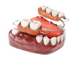 DentalImplants-image6.png