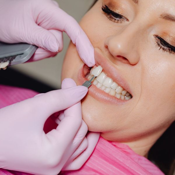 dentist applying veneers