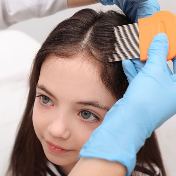 The Dangers of Using Harsh Chemicals for Lice Removal - Image 4.jpg