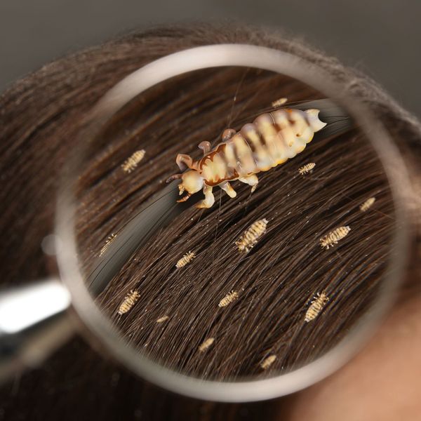 The Truth About Lice_ Separating Fact from Fiction - image3.jpg