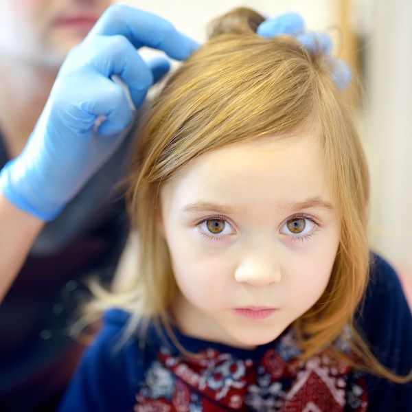 little girl undergoing lice treatment