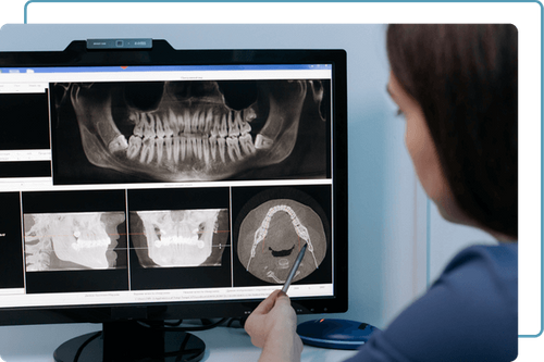 dental x-rays dental x-rays