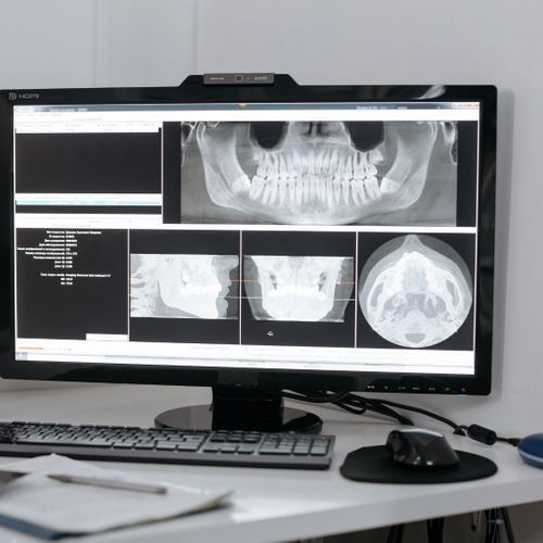 dental x-rays dental x-rays