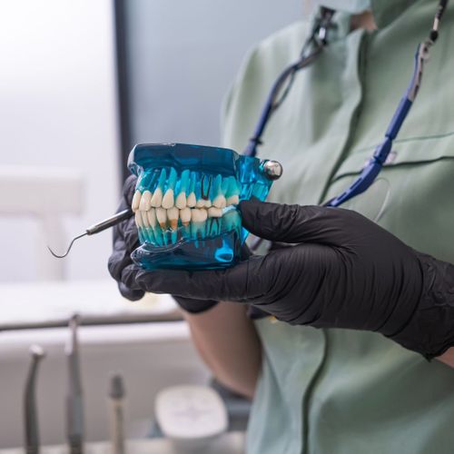 mold of teeth mold of teeth