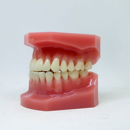 Signs You May Need Periodontal Treatment (2).jpg