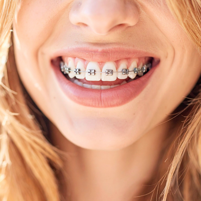 Will Orthodontic Treatment Hurt-1.png