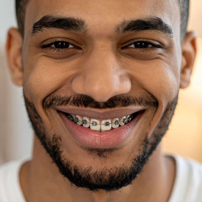 1 Braces or Invisalign_ The Essential Guide to Choosing Your Path to a Straighter Smile.jpg