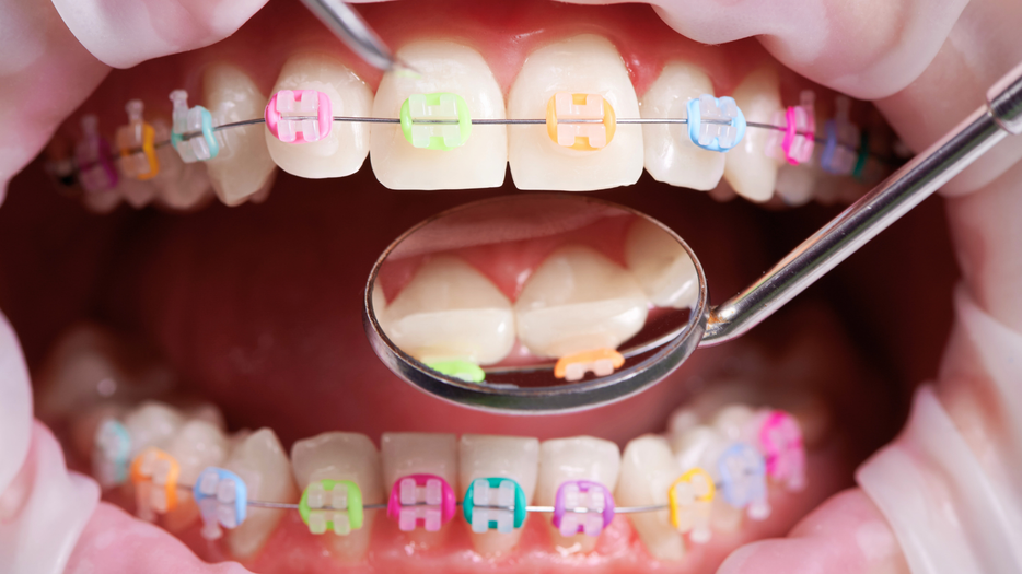 Will Orthodontic Treatment Hurt-HERO.png