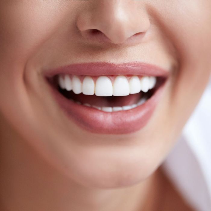 woman with straight white teeth