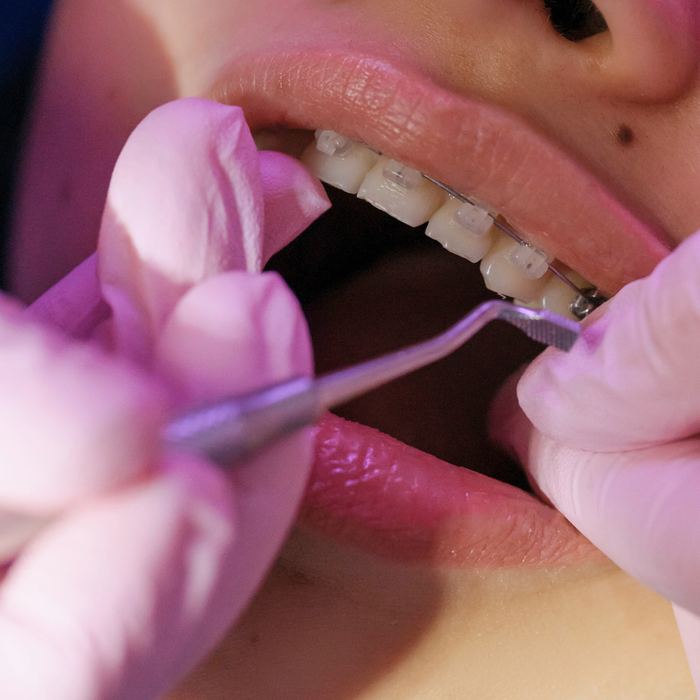 Will Orthodontic Treatment Hurt-2.png
