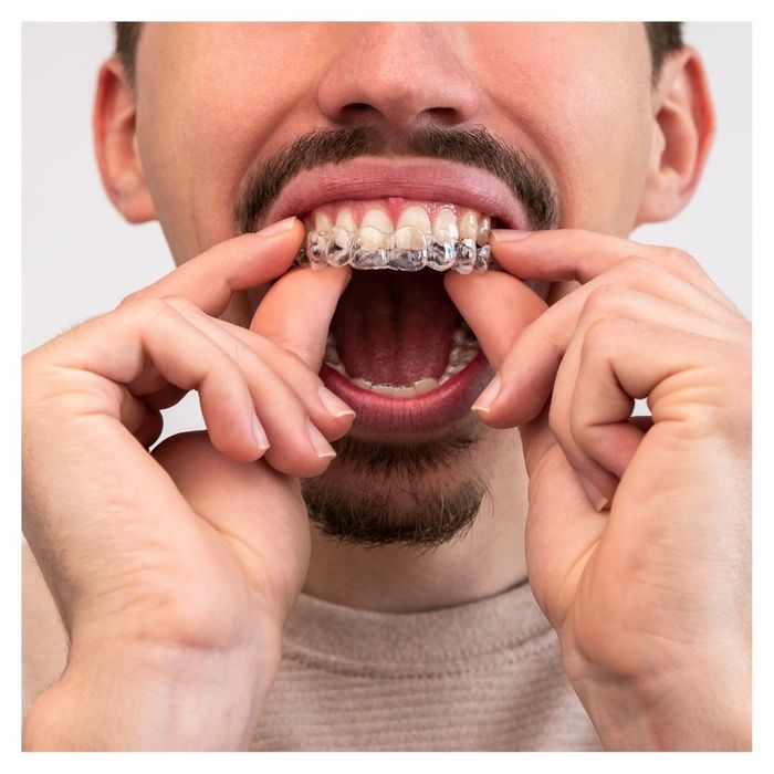 man putting in a retainer