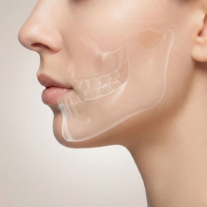 A profile view illustrating the relationship between the jaw structure and facial profile.
