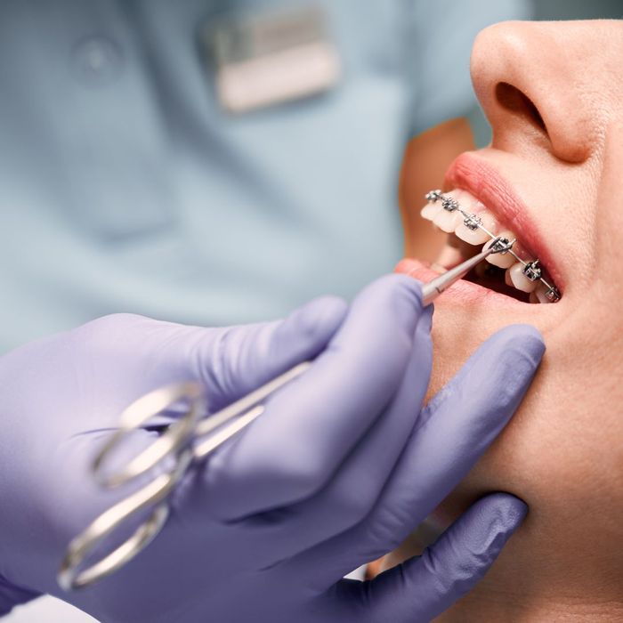 girl with braces at orthodontist