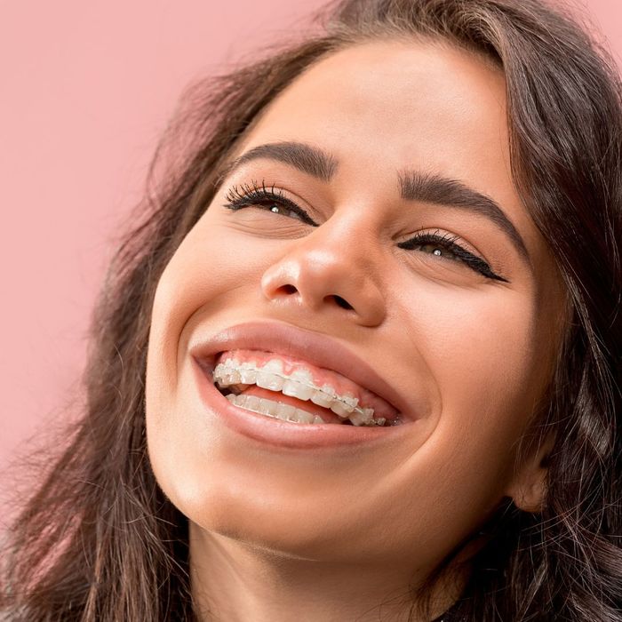 woman smiling with modern traditional braces