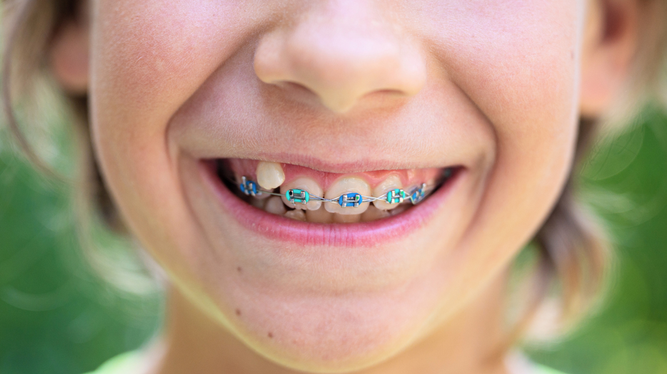 The Importance of Early Orthodontic Evaluation for Children-HERO.png