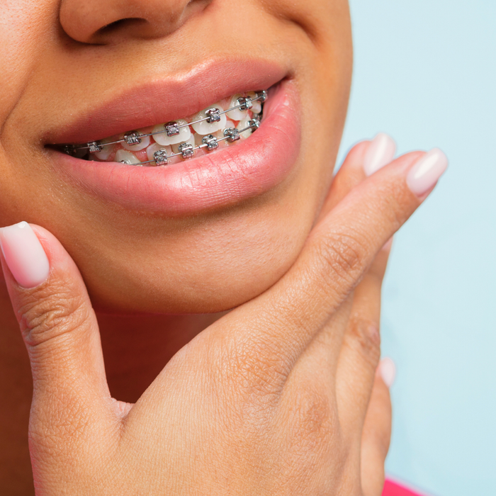 The Importance of Early Orthodontic Evaluation for Children-3.png