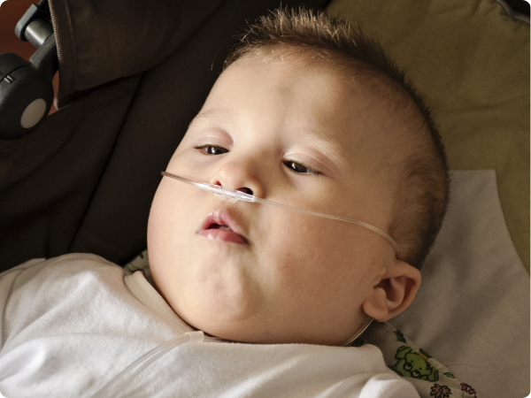 a boy connected to an oxygen machine