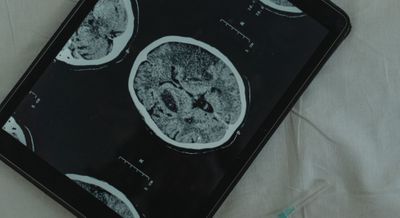 Living With Traumatic Brain Injury at Riviera Living -  hero.jpg