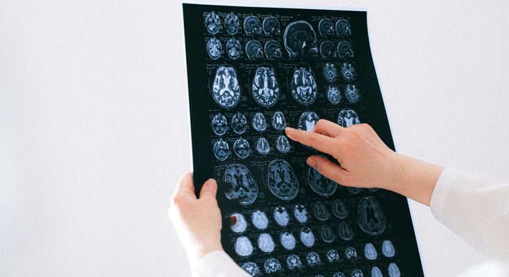 Addressing Emotional Well-Being in Traumatic Brain Injury Recovery.jpg