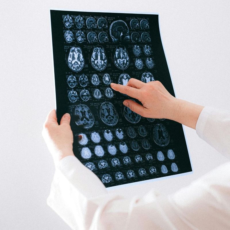 brain scans
