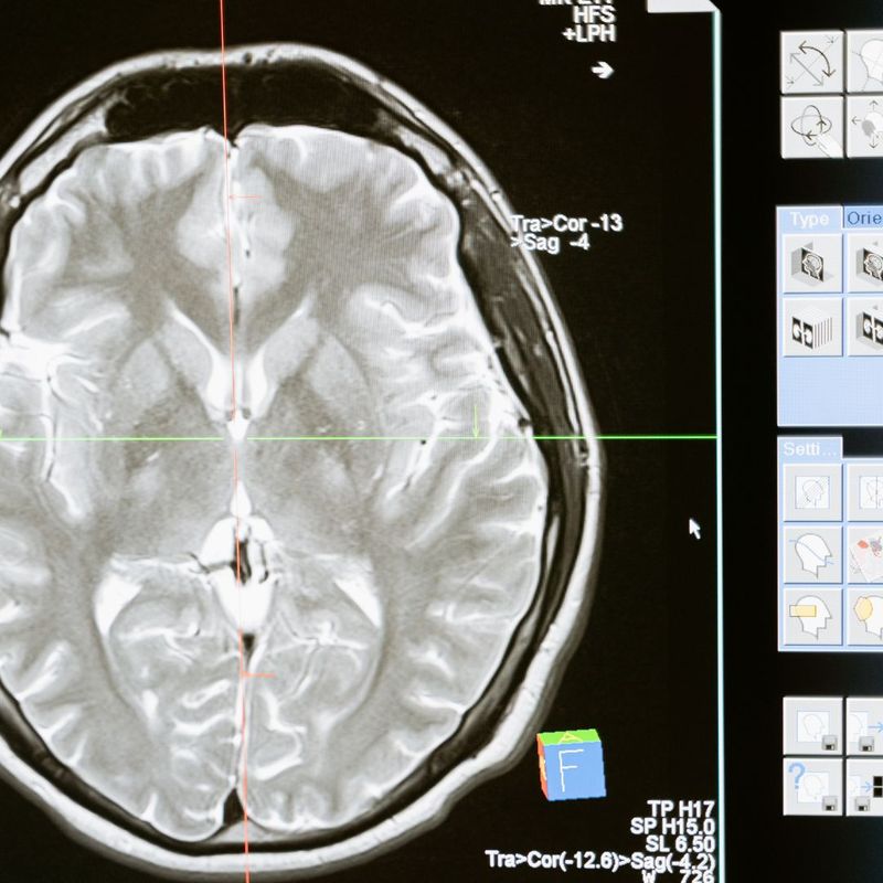 brain scan