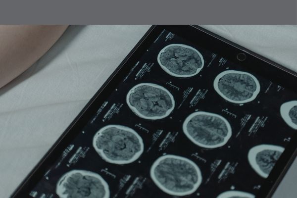 brain x-rays