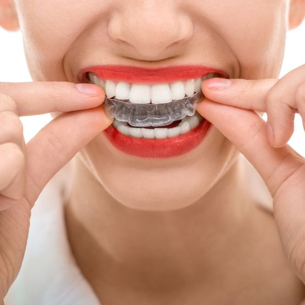 woman putting in clear braces