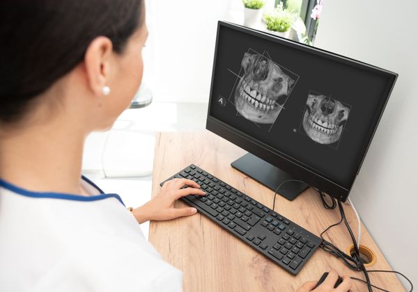 dentist looking at 3d dental images