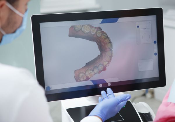 dentist looking at 3D scan on screen