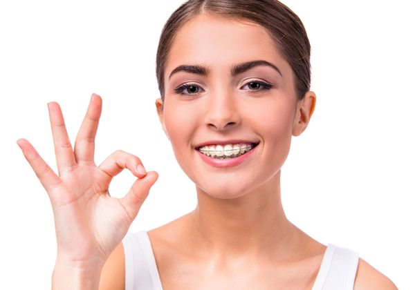 woman with fastbraces on