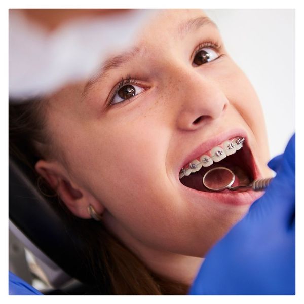 Kids Orthodontics image 3.jpg