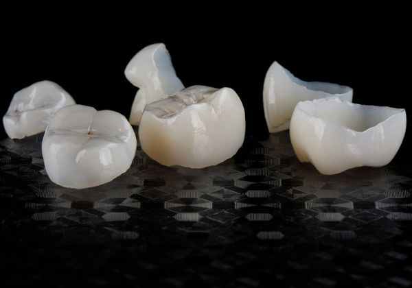 dental crowns