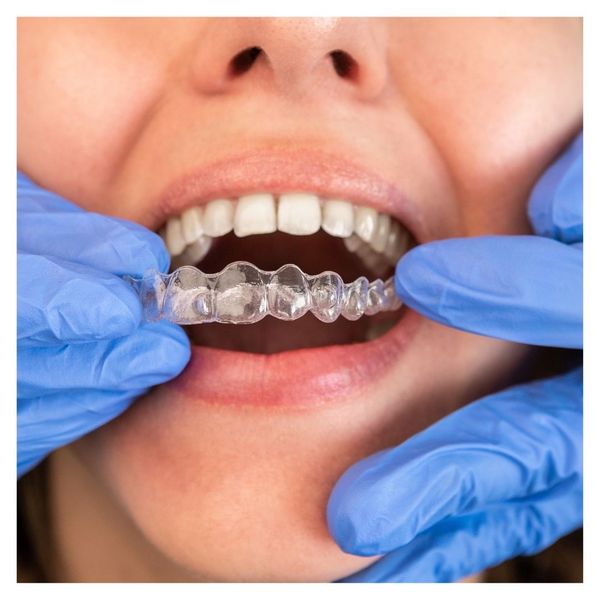 Understanding Invisalign image 1.jpg