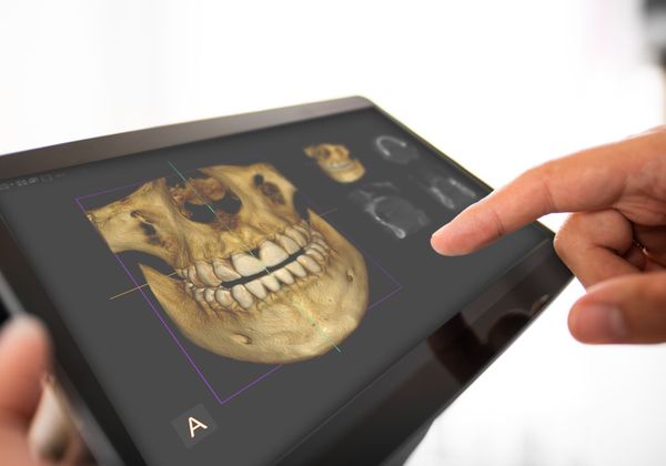 dentist holding 3D dental scan image